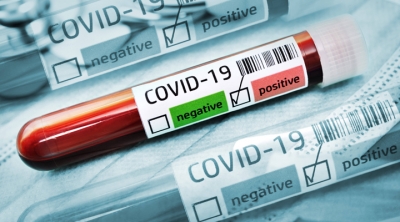 Koronavirüse Yakalanan Muhasebeciye Maliye Desteği